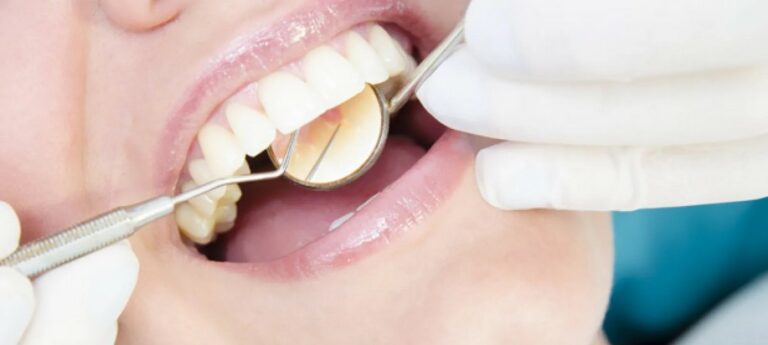 30 Awful Side Effects Of Allopathic Medicines For Bleeding Gums Treatments And Alternates